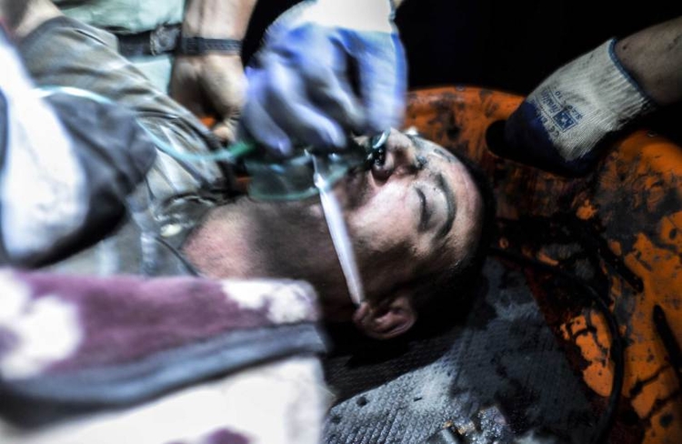 fot. Bulent Kilic / AFP / Getty Images / 13 maja 2014
Górnik, który ucierpiał na skutek eksplozji w Manisie